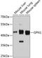 GPN-Loop GTPase 1 antibody, GTX66090, GeneTex, Western Blot image 
