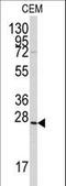 Gremlin 1, DAN Family BMP Antagonist antibody, LS-C100381, Lifespan Biosciences, Western Blot image 