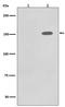 EGFR antibody, P00023-1, Boster Biological Technology, Western Blot image 