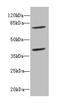 CBFA2/RUNX1 Partner Transcriptional Co-Repressor 2 antibody, orb40254, Biorbyt, Western Blot image 