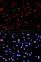 Keratin 19 antibody, orb129657, Biorbyt, Immunocytochemistry image 