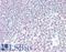 Zinc finger protein Helios antibody, LS-B15489, Lifespan Biosciences, Immunohistochemistry paraffin image 