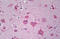 Par-3 Family Cell Polarity Regulator antibody, MBS247081, MyBioSource, Immunohistochemistry frozen image 