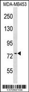 Collagen Type VIII Alpha 1 Chain antibody, 59-065, ProSci, Western Blot image 