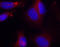 Zeta Chain Of T Cell Receptor Associated Protein Kinase 70 antibody, STJ22448, St John