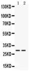 Cathepsin G antibody, PA5-79098, Invitrogen Antibodies, Western Blot image 