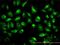 Testin LIM Domain Protein antibody, H00026136-M01, Novus Biologicals, Immunofluorescence image 