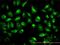 Testin antibody, H00026136-M01, Novus Biologicals, Immunofluorescence image 