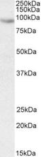 CDKN1A Interacting Zinc Finger Protein 1 antibody, NBP2-26207, Novus Biologicals, Western Blot image 