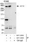 SET Domain Containing 1B, Histone Lysine Methyltransferase antibody, NBP1-28685, Novus Biologicals, Immunoprecipitation image 