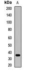 Corticotropin Releasing Hormone Binding Protein antibody, LS-C667751, Lifespan Biosciences, Western Blot image 