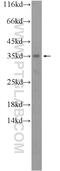 Acyl-CoA Binding Domain Containing 4 antibody, 20941-1-AP, Proteintech Group, Western Blot image 