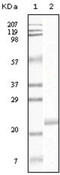 EPH Receptor B4 antibody, abx010727, Abbexa, Enzyme Linked Immunosorbent Assay image 