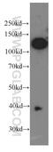 Melanoma Cell Adhesion Molecule antibody, 66153-1-Ig, Proteintech Group, Western Blot image 