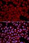 Protein Phosphatase 1 Catalytic Subunit Beta antibody, LS-B14855, Lifespan Biosciences, Immunofluorescence image 