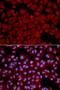 Serine/threonine-protein phosphatase PP1-beta catalytic subunit antibody, LS-B14855, Lifespan Biosciences, Immunofluorescence image 