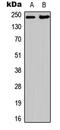 Extra Spindle Pole Bodies Like 1, Separase antibody, GTX56240, GeneTex, Western Blot image 