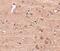 Nucleoporin GLE1 antibody, NBP1-76975, Novus Biologicals, Immunohistochemistry paraffin image 