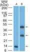 Cytokine Receptor Like Factor 2 antibody, NBP2-22384, Novus Biologicals, Western Blot image 