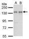 Nuclear Factor Of Activated T Cells 2 antibody, GTX127932, GeneTex, Western Blot image 