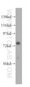 Fermitin Family Member 2 antibody, 11453-1-AP, Proteintech Group, Western Blot image 