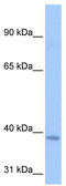 NOP2/Sun RNA Methyltransferase 3 antibody, TA346816, Origene, Western Blot image 