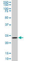 Ubiquitin C-Terminal Hydrolase L3 antibody, LS-C198401, Lifespan Biosciences, Western Blot image 