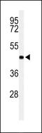 Regulation Of Nuclear Pre-MRNA Domain Containing 1B antibody, 64-186, ProSci, Western Blot image 