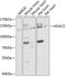 Histone Deacetylase 5 antibody, 13-228, ProSci, Western Blot image 