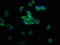 Tubulin Beta 3 Class III antibody, LS-C318906, Lifespan Biosciences, Immunofluorescence image 