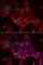 Myotilin antibody, A6439, ABclonal Technology, Immunofluorescence image 