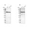 Leucine Rich Repeat Containing 47 antibody, NBP1-93597, Novus Biologicals, Western Blot image 