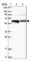Leucine Rich Repeat Containing 1 antibody, NBP1-88016, Novus Biologicals, Western Blot image 