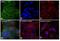 Erb-B2 Receptor Tyrosine Kinase 3 antibody, MA1-860, Invitrogen Antibodies, Immunofluorescence image 