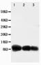 C-X-C Motif Chemokine Ligand 10 antibody, LS-C312561, Lifespan Biosciences, Western Blot image 