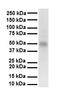 Protein Inhibitor Of Activated STAT 2 antibody, orb329894, Biorbyt, Western Blot image 