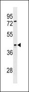 Signal Regulatory Protein Beta 2 antibody, 60-379, ProSci, Western Blot image 