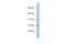 Chromosome 19 Open Reading Frame 25 antibody, A17150, Boster Biological Technology, Western Blot image 