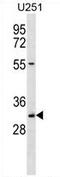 Transcription Elongation Factor A2 antibody, AP54197PU-N, Origene, Western Blot image 