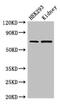 Rab Geranylgeranyltransferase Subunit Alpha antibody, CSB-PA852898LA01HU, Cusabio, Western Blot image 