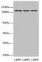 Methylenetetrahydrofolate Dehydrogenase (NADP+ Dependent) 1 Like antibody, LS-C676086, Lifespan Biosciences, Western Blot image 