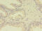 Methylenetetrahydrofolate Reductase antibody, CSB-PA015158LA01HU, Cusabio, Immunohistochemistry paraffin image 