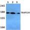 Mediator Complex Subunit 1 antibody, PA5-36114, Invitrogen Antibodies, Western Blot image 