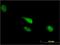 Cell Division Cycle 23 antibody, H00008697-M08, Novus Biologicals, Immunocytochemistry image 