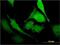 Pseudouridine Synthase 1 antibody, H00080324-M01, Novus Biologicals, Immunocytochemistry image 