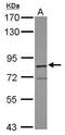 Ras guanyl-releasing protein 3 antibody, GTX104706, GeneTex, Western Blot image 