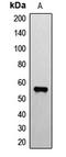 ETS Variant 1 antibody, LS-C352170, Lifespan Biosciences, Western Blot image 