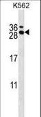 RCAN Family Member 3 antibody, LS-C162512, Lifespan Biosciences, Western Blot image 