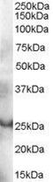 GRB2 Related Adaptor Protein antibody, GTX89994, GeneTex, Western Blot image 