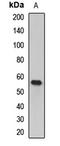 FGR Proto-Oncogene, Src Family Tyrosine Kinase antibody, orb412062, Biorbyt, Western Blot image 